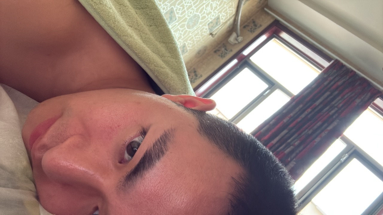 中暑加落枕也是没有谁了昨天理疗了一下好多了今天继续 