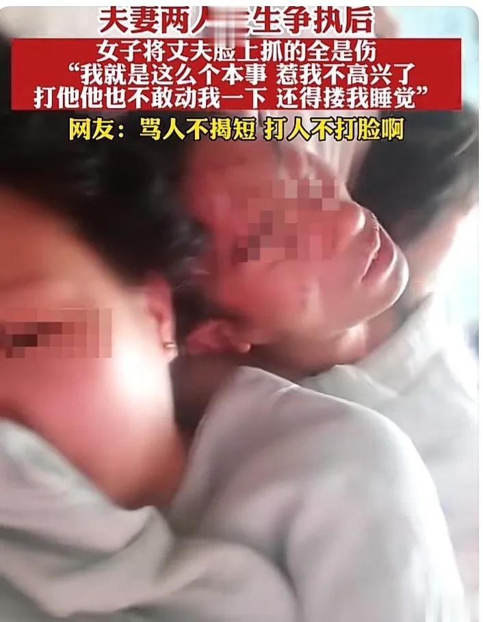 夫妻俩闹矛盾，丈夫主动承认错误，妻子却不依不饶，将丈夫的脸抓得全是伤。事后女子丝