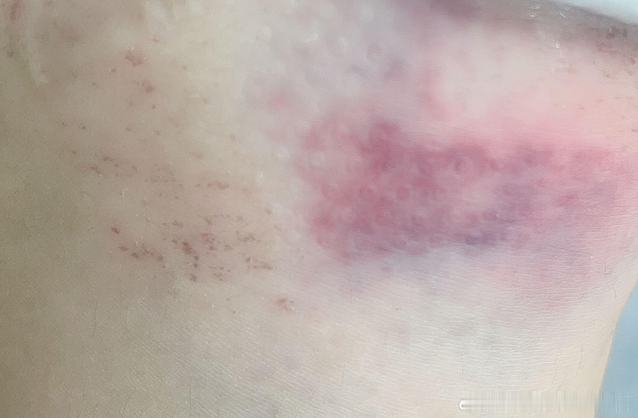 我又被车撞了……好悲伤…… 