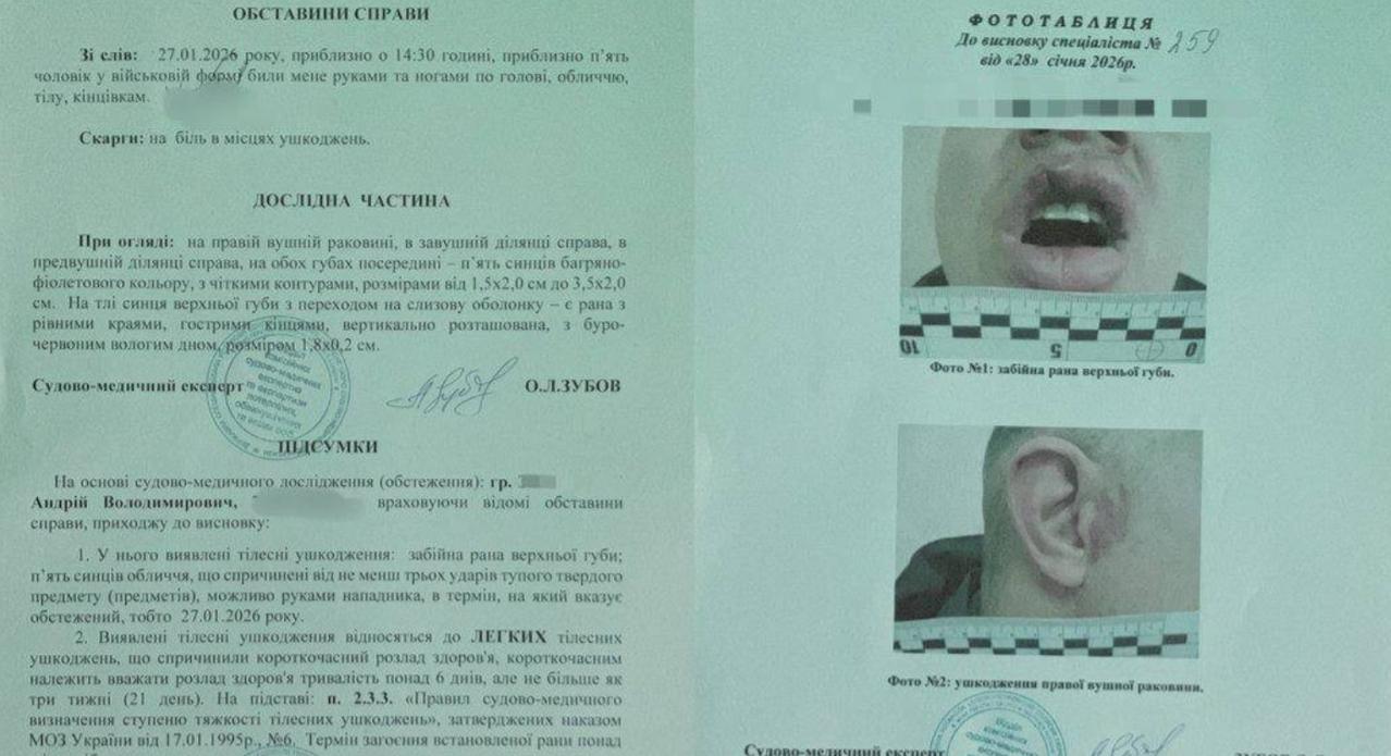 乌克兰征兵官殴打退伍老兵事件后续！

还记得前段时间闹得全网关注的乌克兰征兵官殴