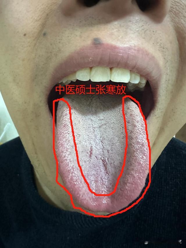 正值壮年，身体却不太行[捂脸][捂脸][捂脸]，这是真的憋屈啊[吃瓜群众][吃瓜