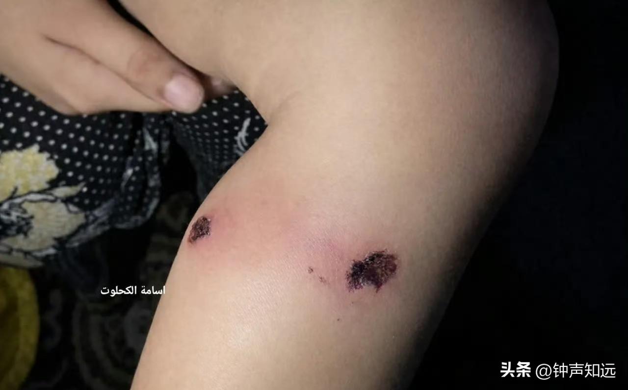 以色列士兵酷刑折磨加沙一岁儿童10小时。
这是2026年3月23日最新曝光的一起