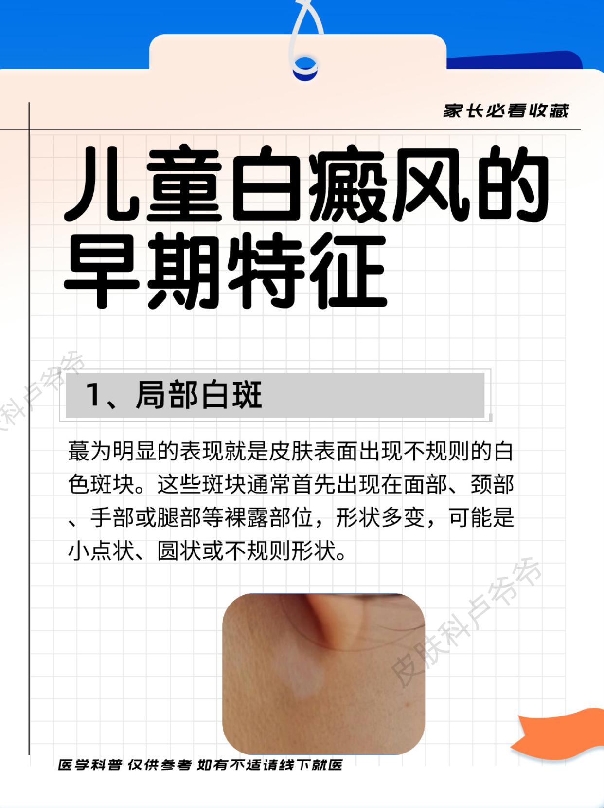 白癜风 白斑 医学科普 江西