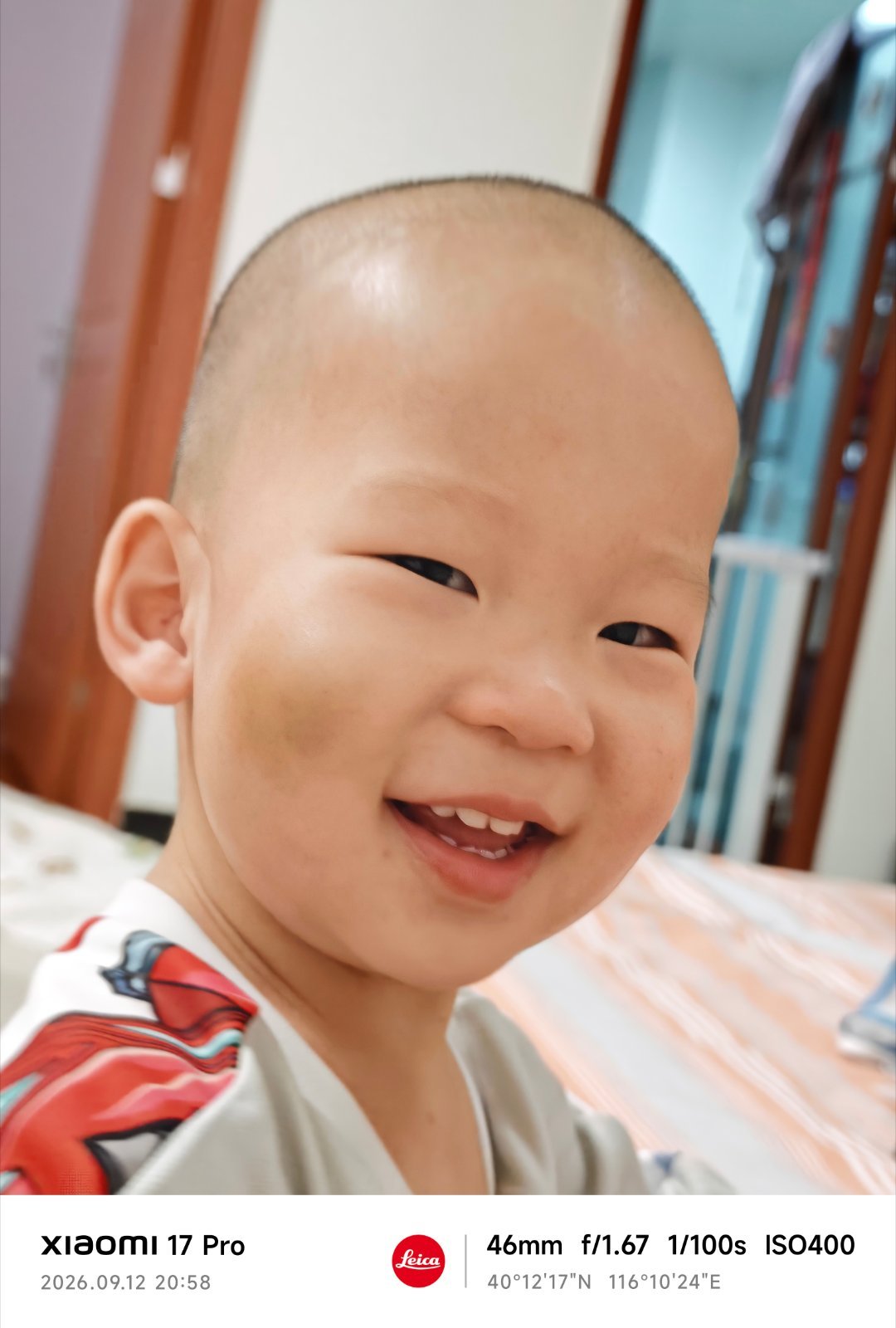 小家伙太闹腾了 隔三差五就挂彩[泪奔] ​​​