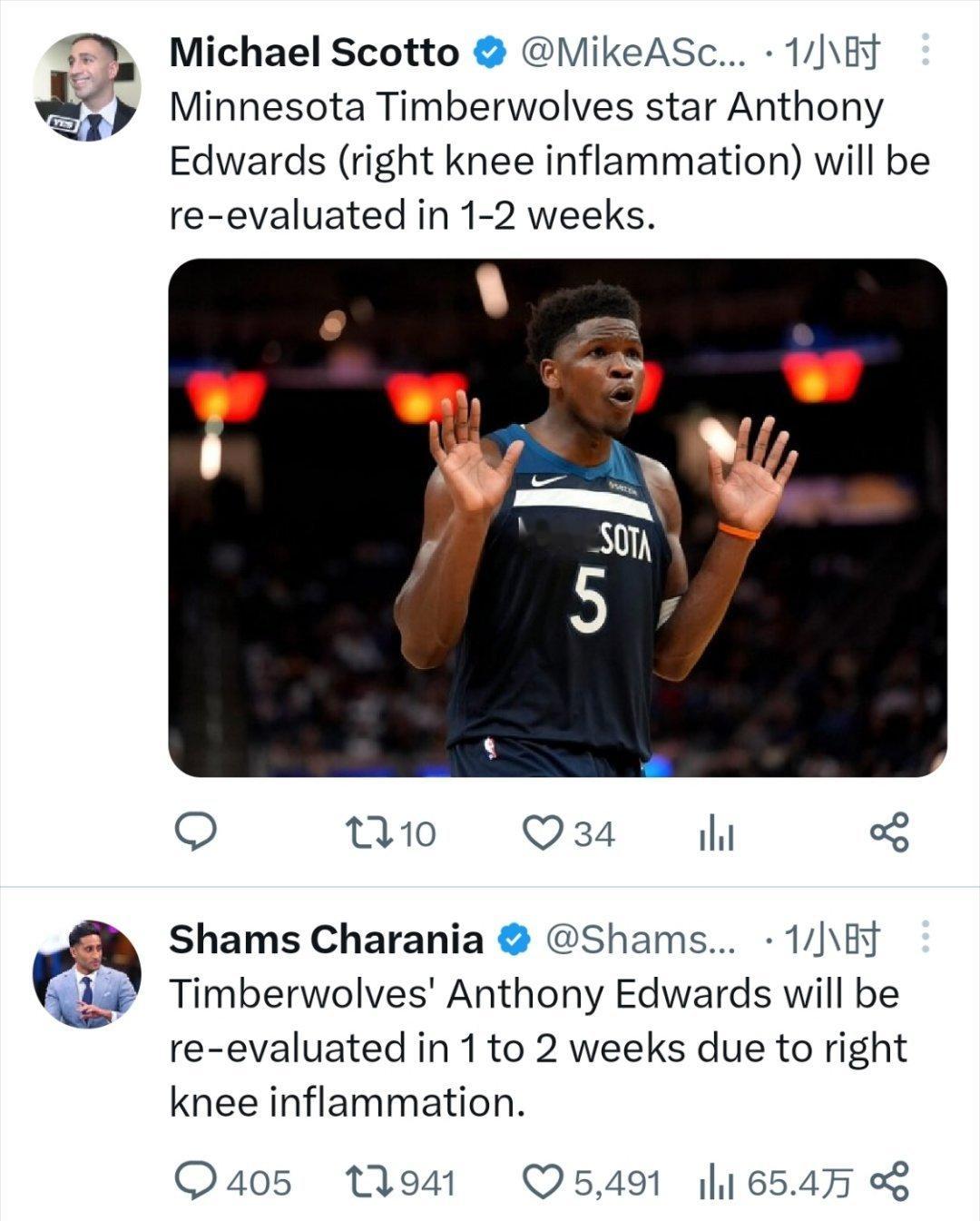 ▲爱德华兹右膝发炎，将在1-2周后接受复查