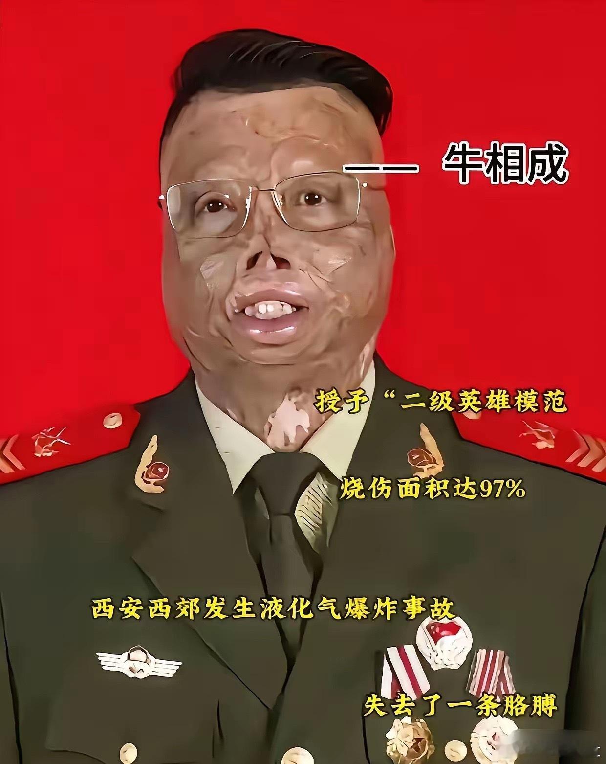 全身97%烧伤、失去一条手臂，荣立一等功、全国公安二级英模；牛相成，甘肃庆阳人，