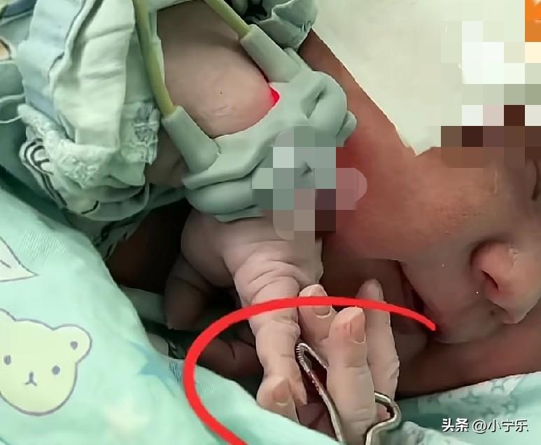 近日，一名在海宁务工10年的河南妈妈带着节育环意外怀孕，产检一路绿灯，最终顺利生