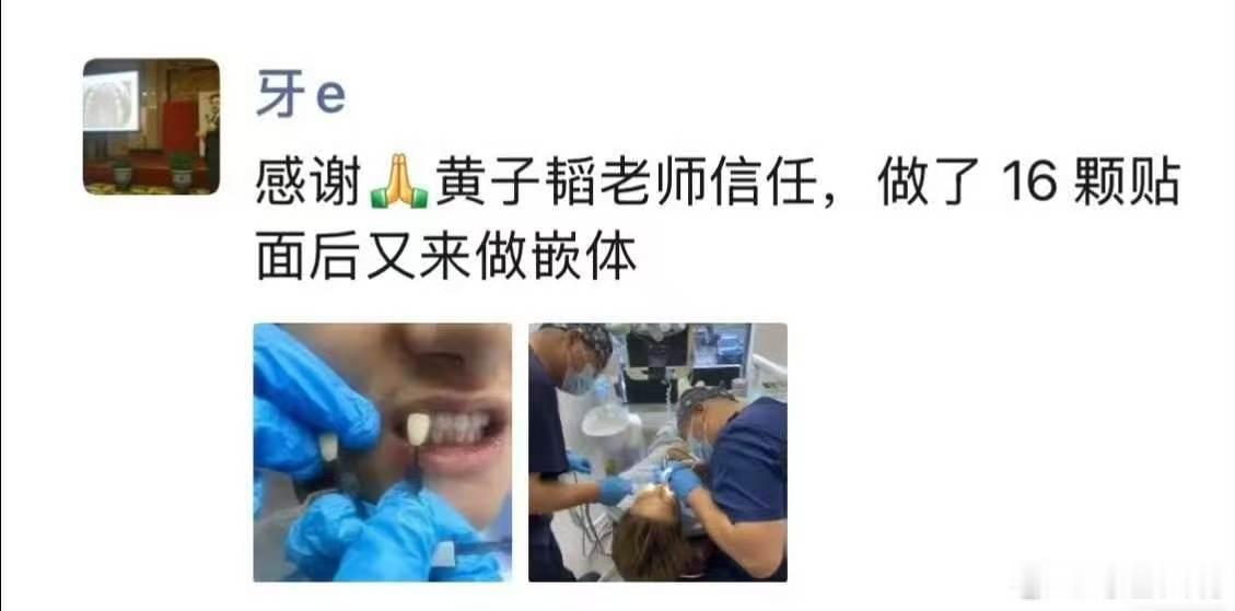 黄子韬说要点脸做生意真的黄子韬说如果不是生前的吴医生 黄子韬回应偷拍争议，希望大