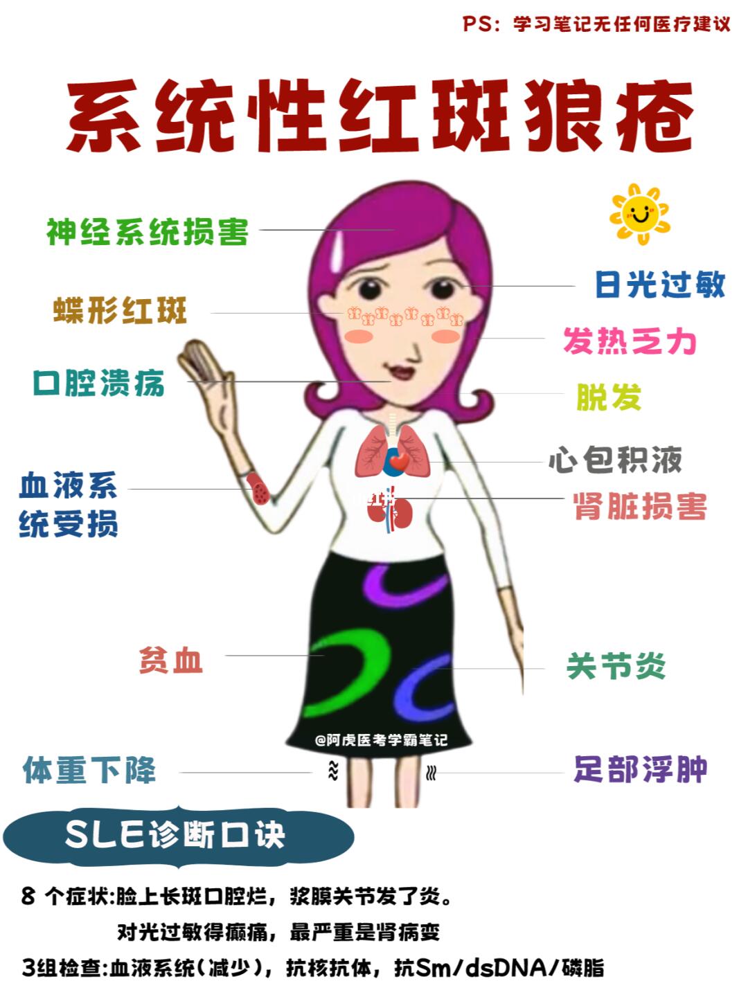 阿虎医考医学生学霸笔记：系统性红斑狼疮