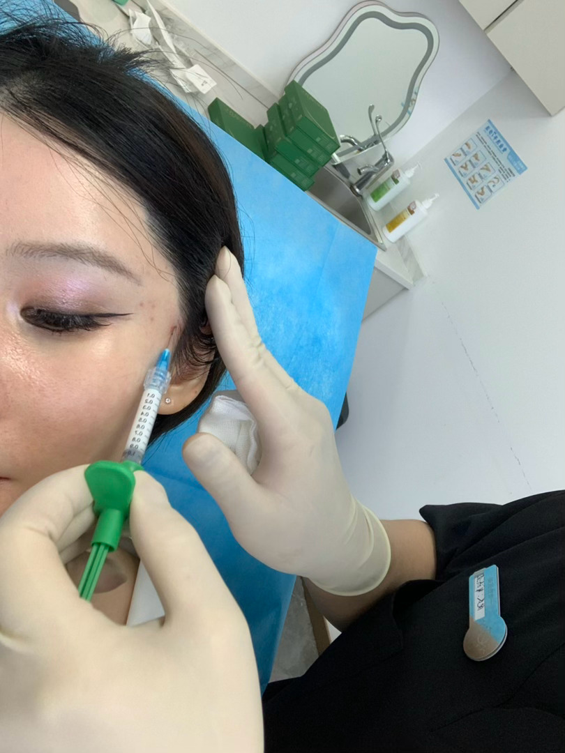 我好搞笑啊，因为待会要去上海，所以现在打针只卸一半的脸，强烈要求保留眼妆 