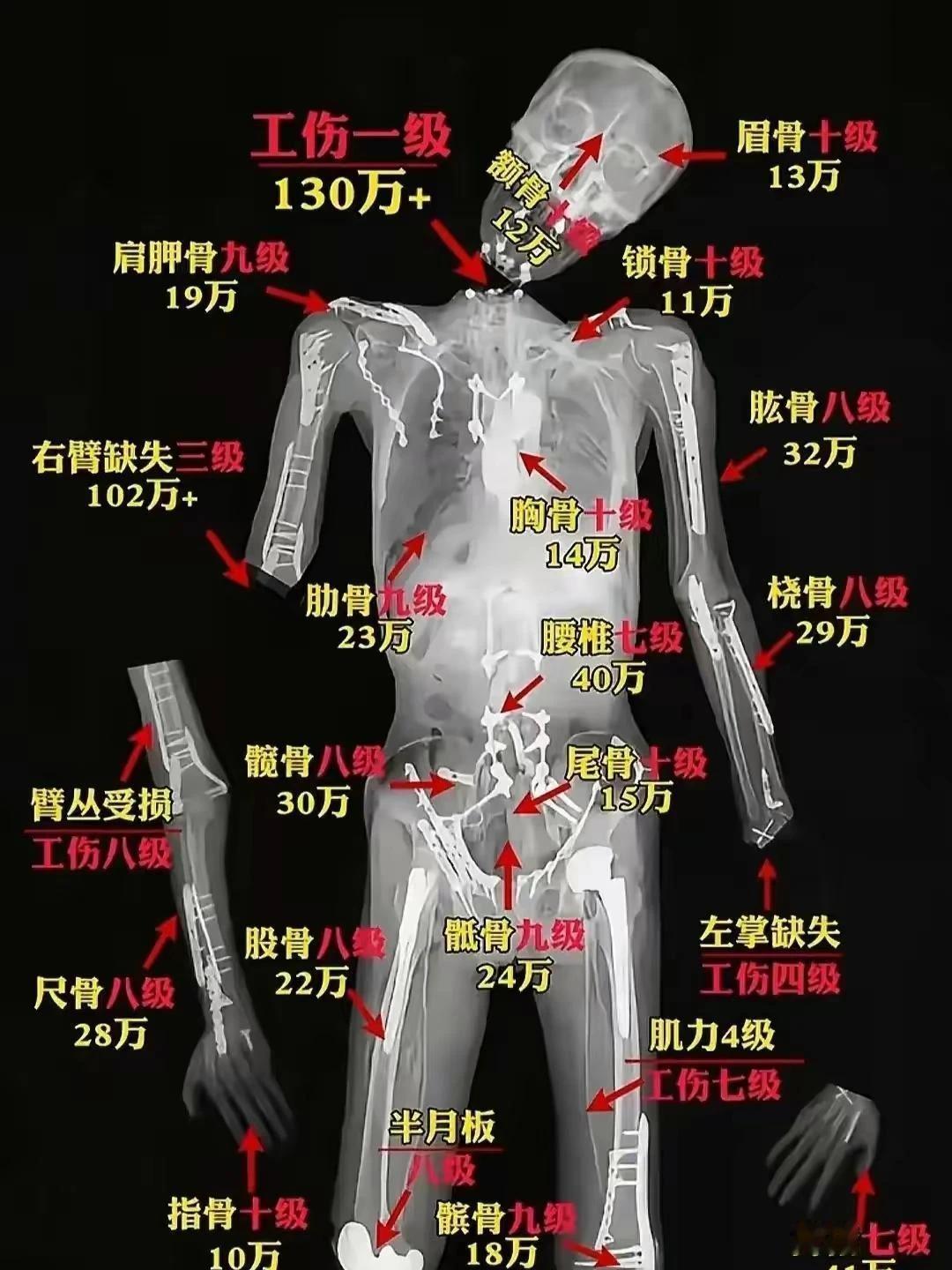 工伤赔偿金的标准
