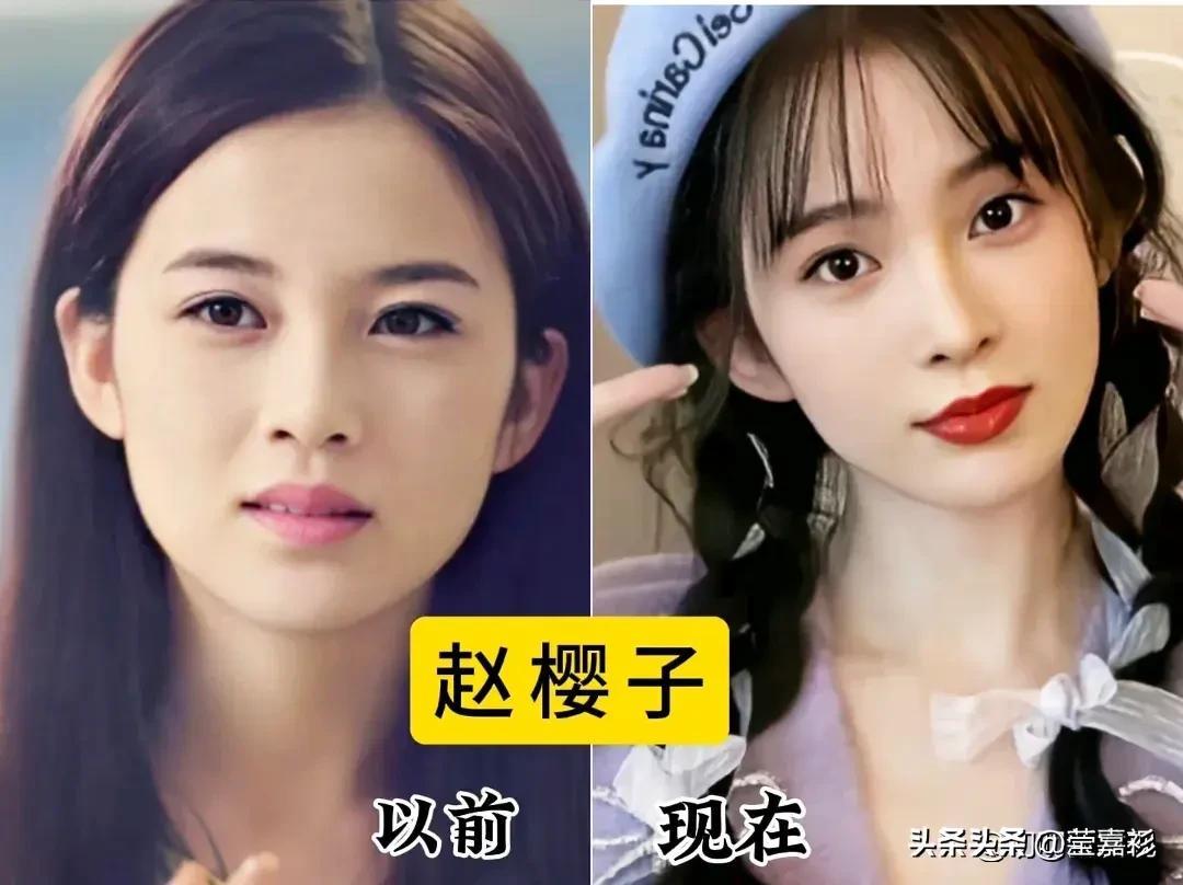 哎，真是让人心疼啊！那些曾经光彩照人的女明星，竟然都变得这么不一样了，整容真的是