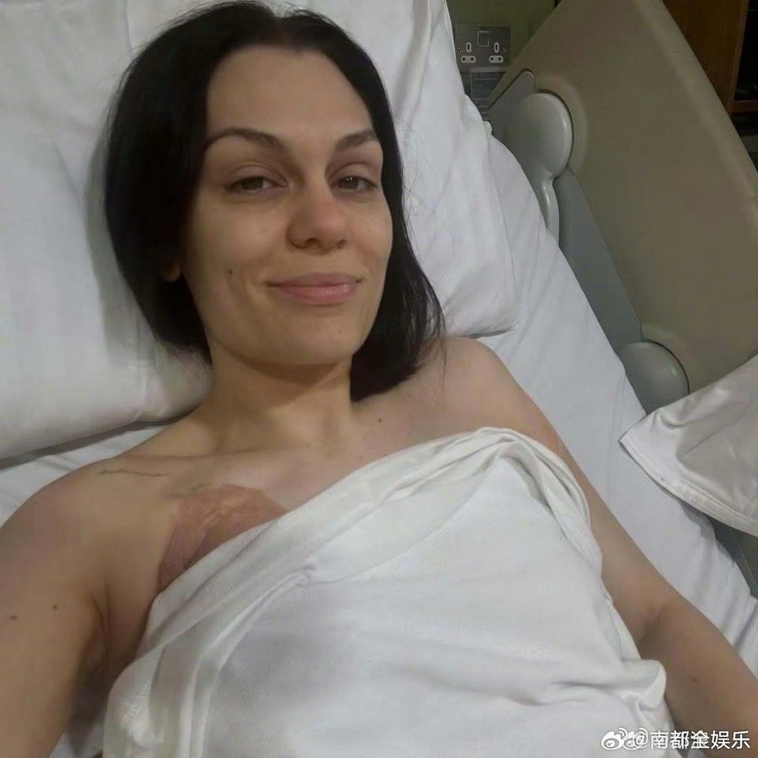 结石姐做乳腺癌手术结石姐乳腺癌手术结束 24日，结石姐分享了自己做乳腺癌手术的照