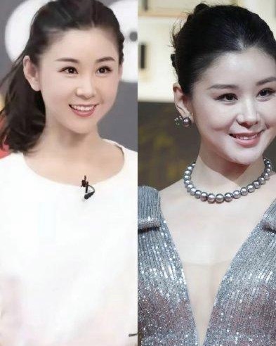 李小萌这个人实在让我看不下去了，不是因为她不够好看，而是因为她的肉从来不长在脸上