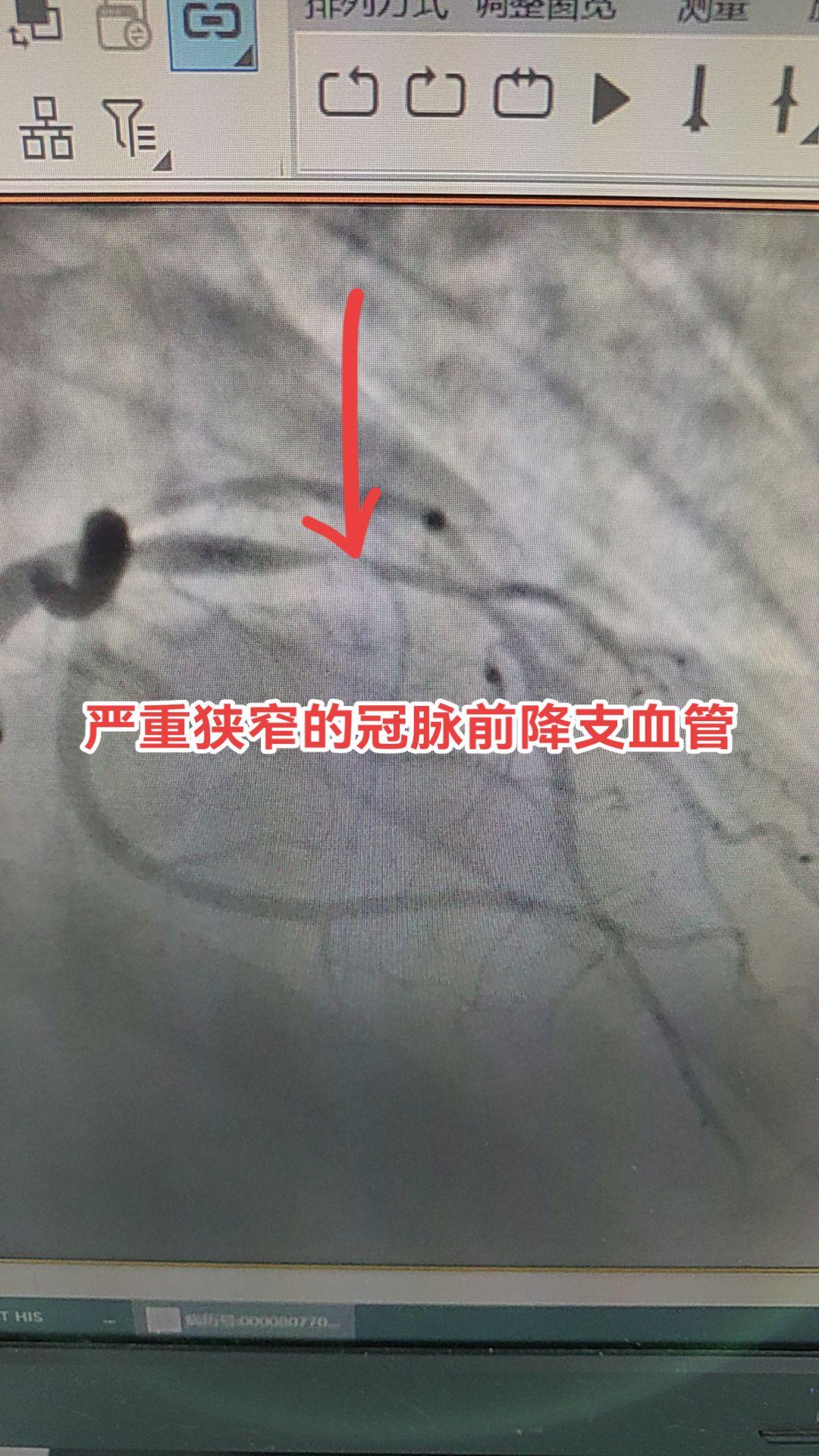 医学影像 医学科普 医生日常