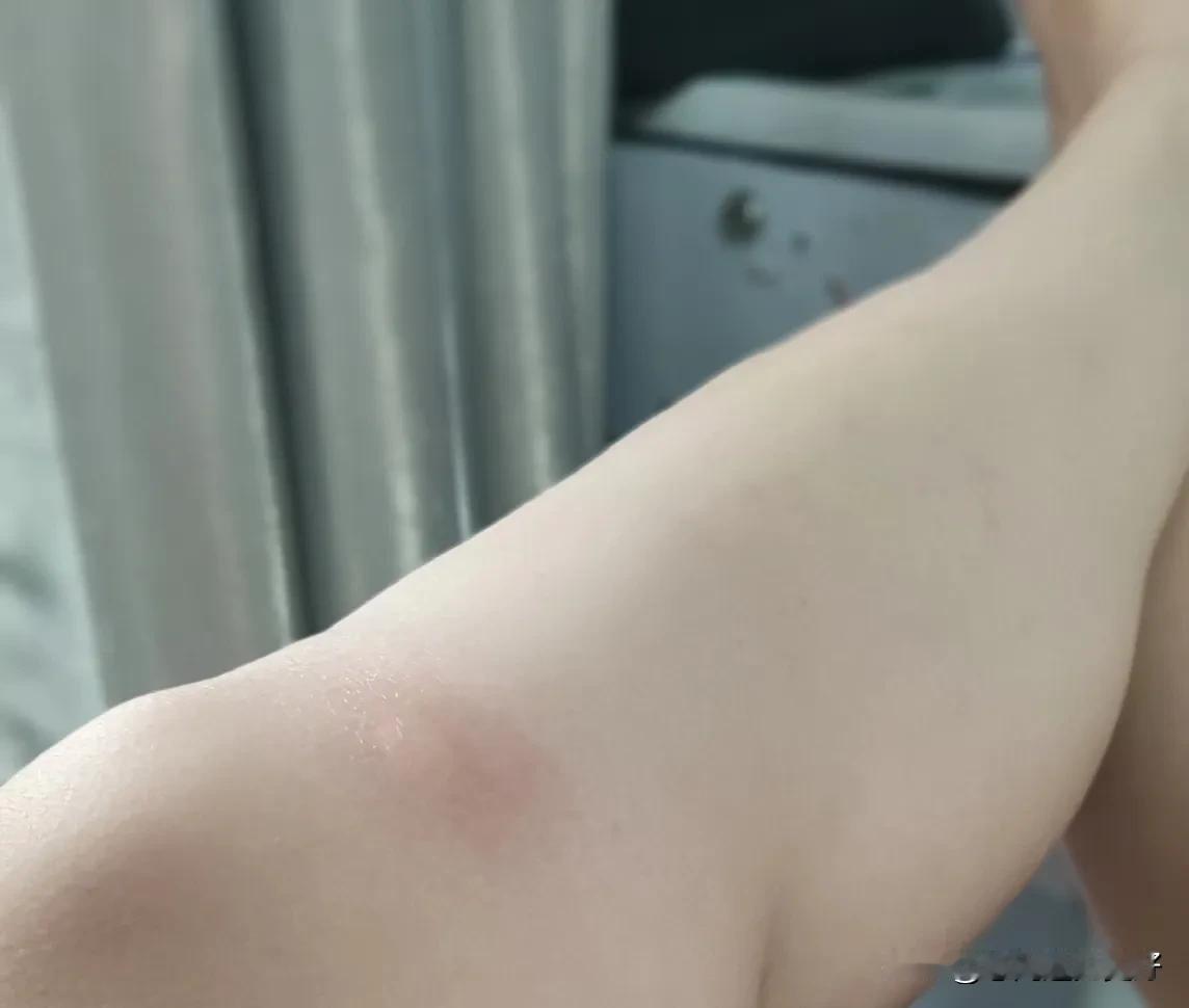 今天穿裙子👗接孩子放学，然后儿子和小朋友在广场玩了一会儿。蚊子亲切的送了我五个