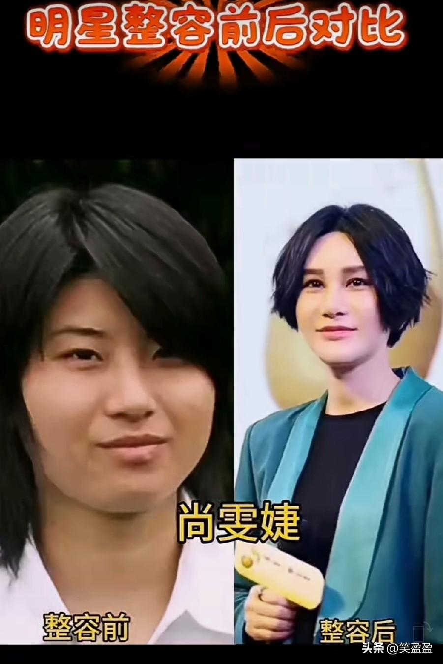 5位女星整容前后对比
谁变漂亮了？