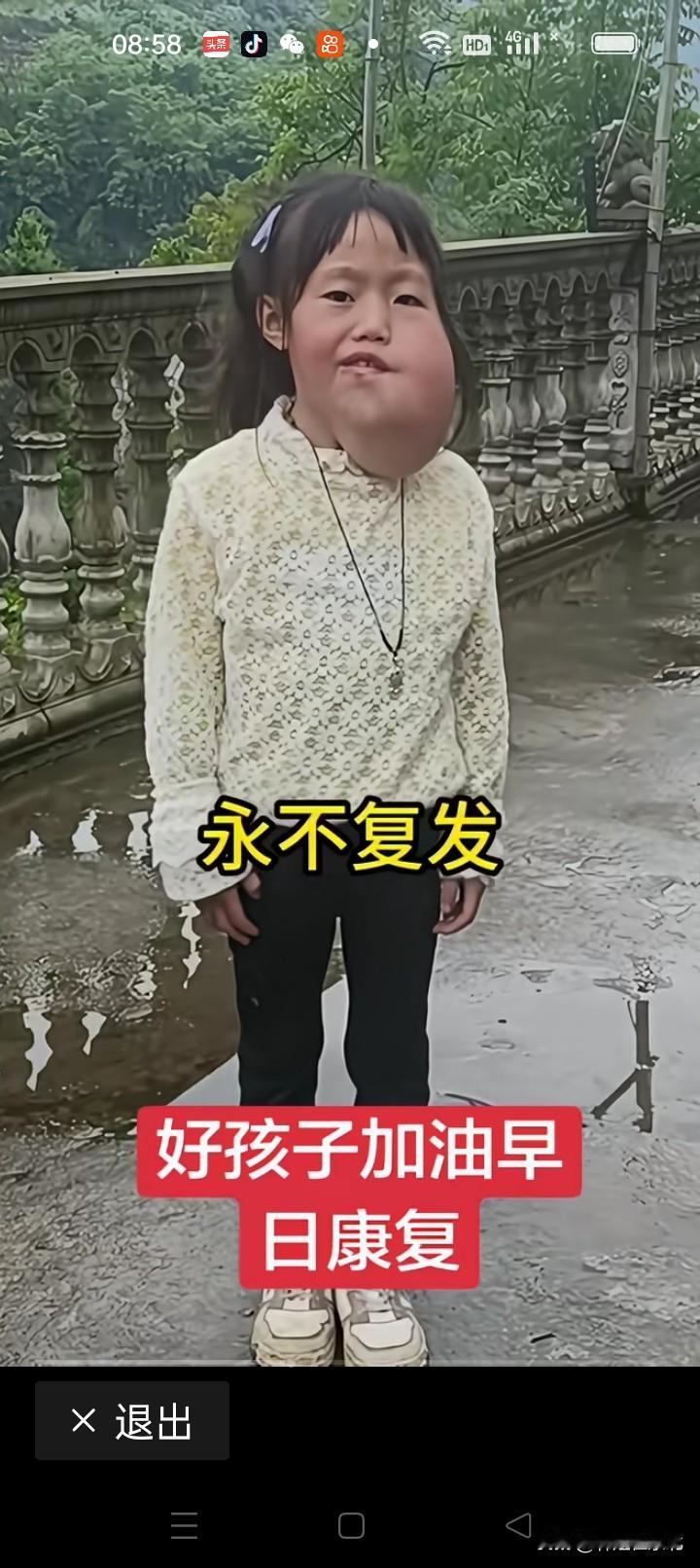 这孩子是啥病呀？为啥家长不领上医院去治疗！看着太可怜了！