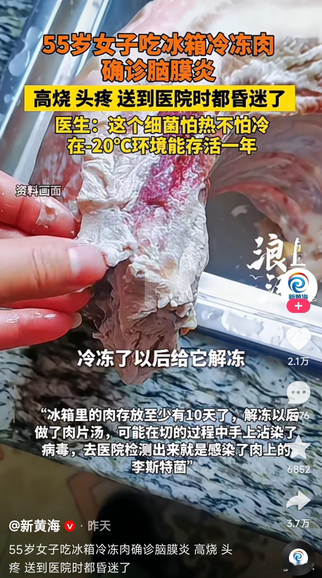 55岁女子吃冰箱冷冻肉居然感染了肉上的细菌病毒，高烧，头疼，送到医院时已昏迷，最