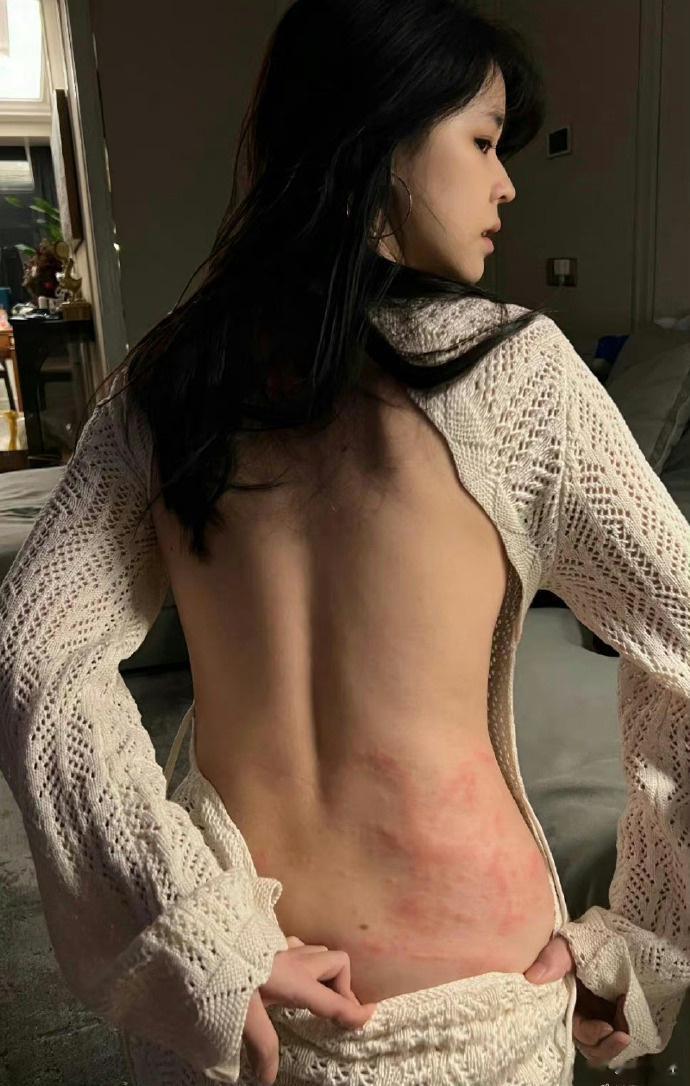 网友：有没有皮肤科的，这是什么情况😳 ​​​