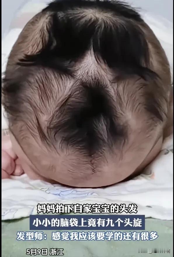 5月9号，浙江有个宝妈，随手拍了段自家宝宝的脑袋，视频里那小小的脑袋瓜子上，密密