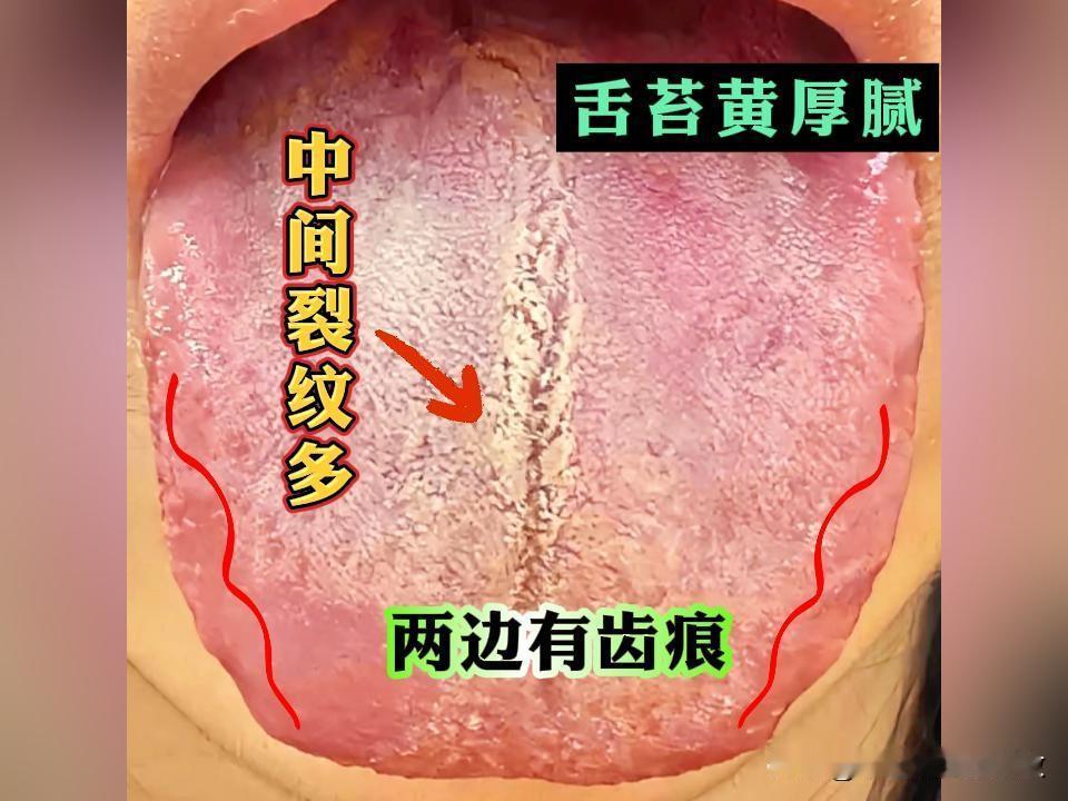 31岁魏先生 手淫史10年 严重的早泄患者[吃瓜群众][吃瓜群众][吃瓜群众][