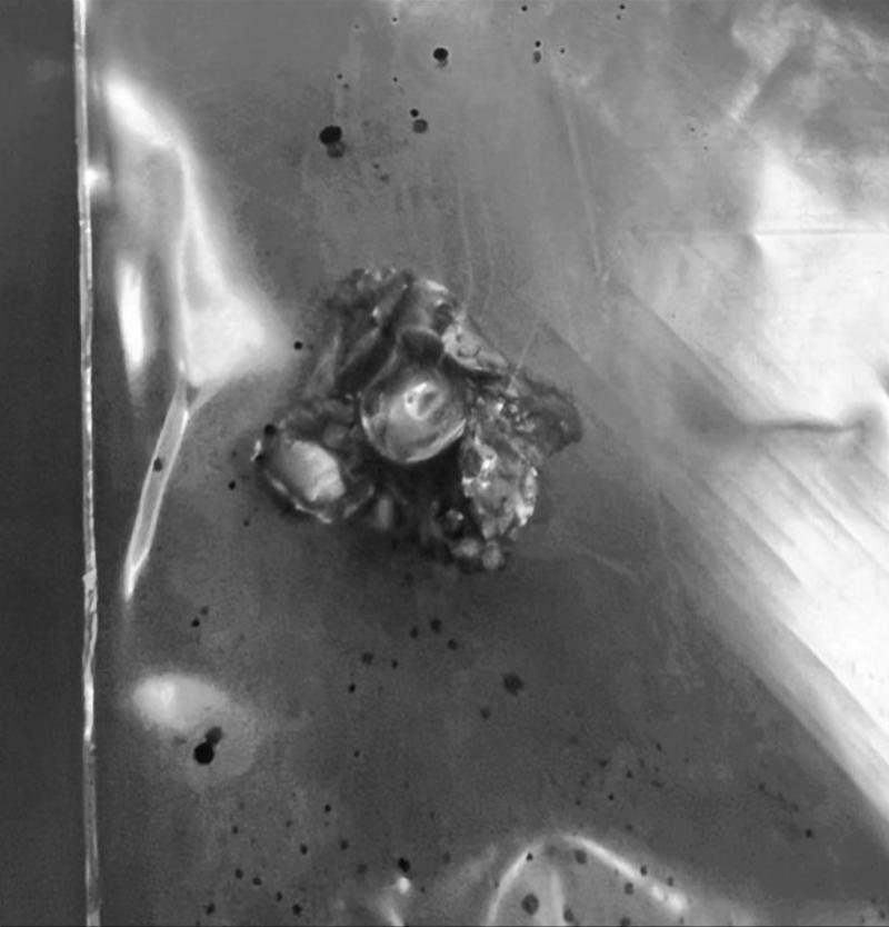 中国驻宋卡总领馆发消息，近期，有中国游客在普吉岛当地射击场被流弹击中，造成面部重