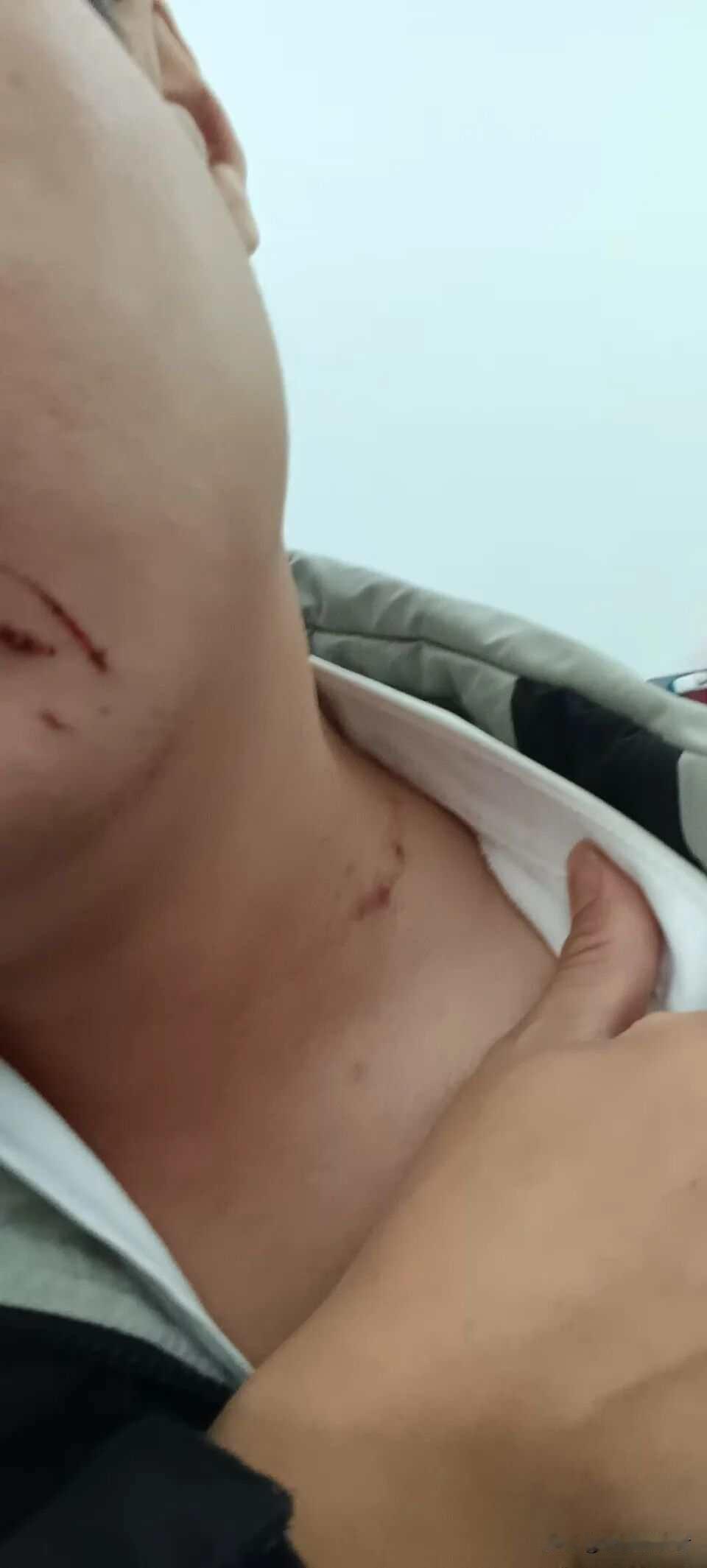 佛山货车司机婚变困局 法院拒离引争议 药盒秘密待解

小王盯着手机屏幕，表哥吕先