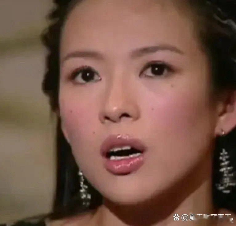章子怡年轻时的痣让她的脸庞更有特色，如今去掉后显得干净，口红色彩更显眼，反倒引发