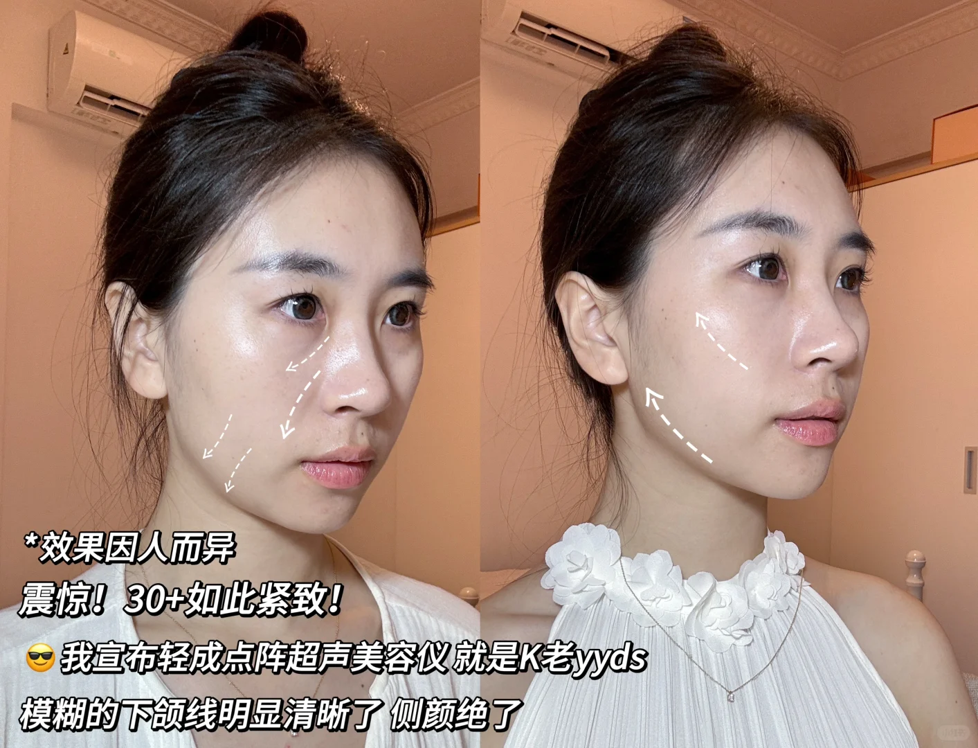30+首选抗老捷径，把紧致侧颜焊在脸上