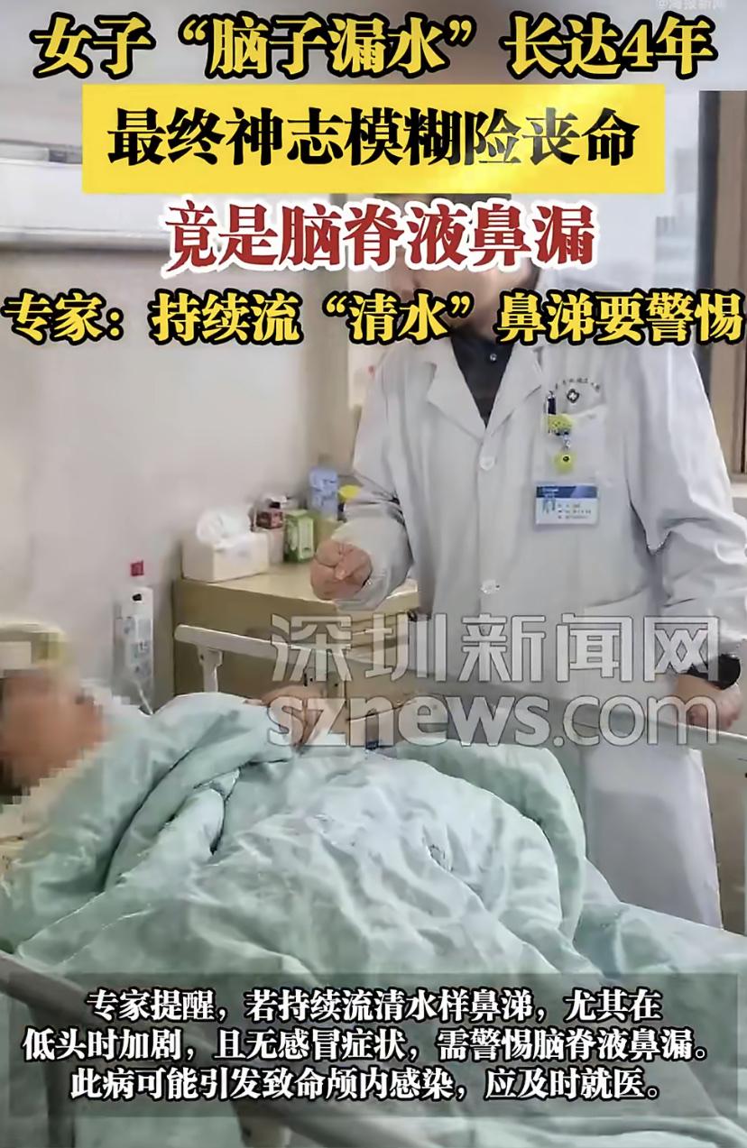 女子被折磨4年流"清水鼻涕"，竟是脑子漏了!医生：这症状千万别大意
长沙的刘女士