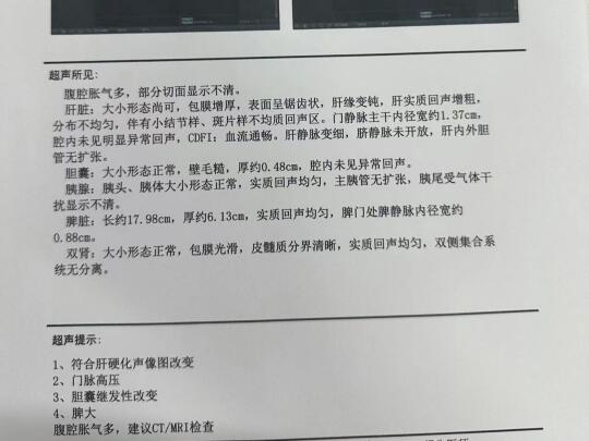 彩超怎么看出肝硬化？肝病专家1分钟教会你