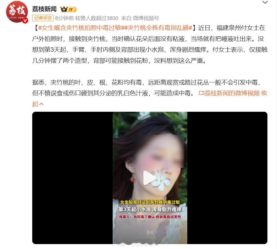 女生嘴含夹竹桃拍照中毒过敏出片有这么重要吗？为了出片，连命都不要了是吧？