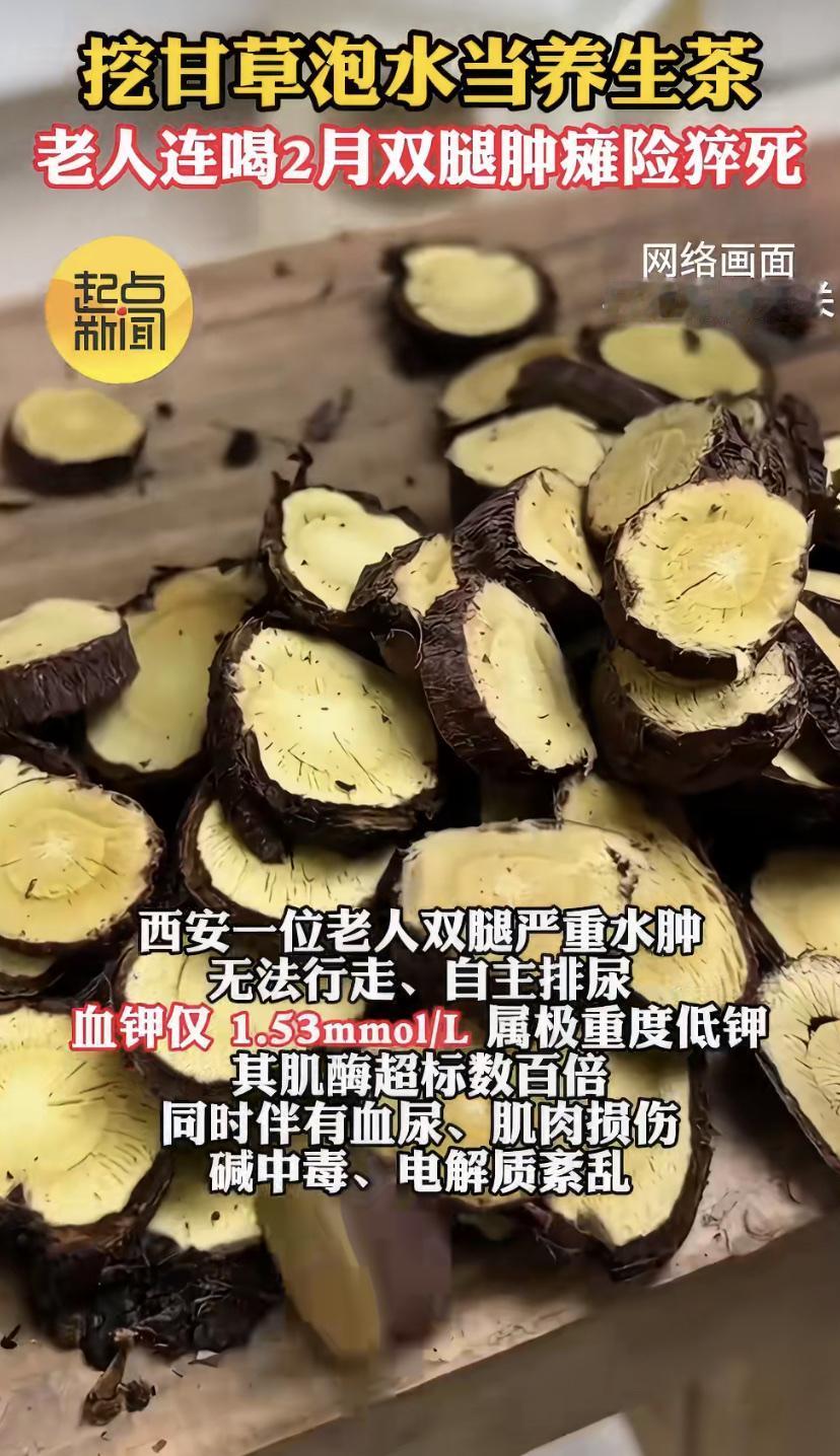 西安一老人为养生，天天拿甘草泡水当茶喝，连喝俩月，结果把自己喝进了抢救室!
送医