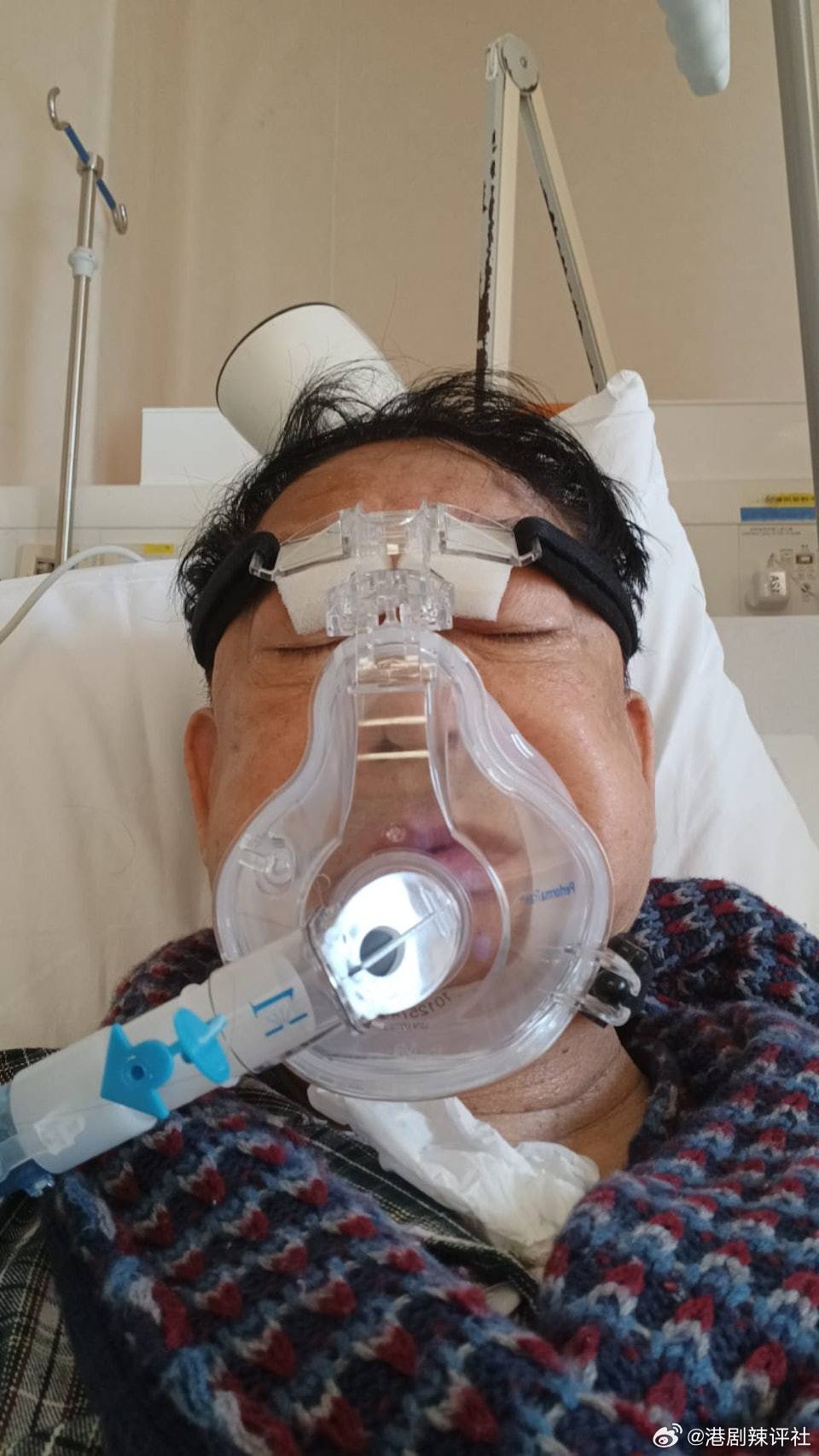 現年76歲的殿堂級填詞人兼演員黎彼得（Peter），近年身體狀況頻頻亮紅燈。早前