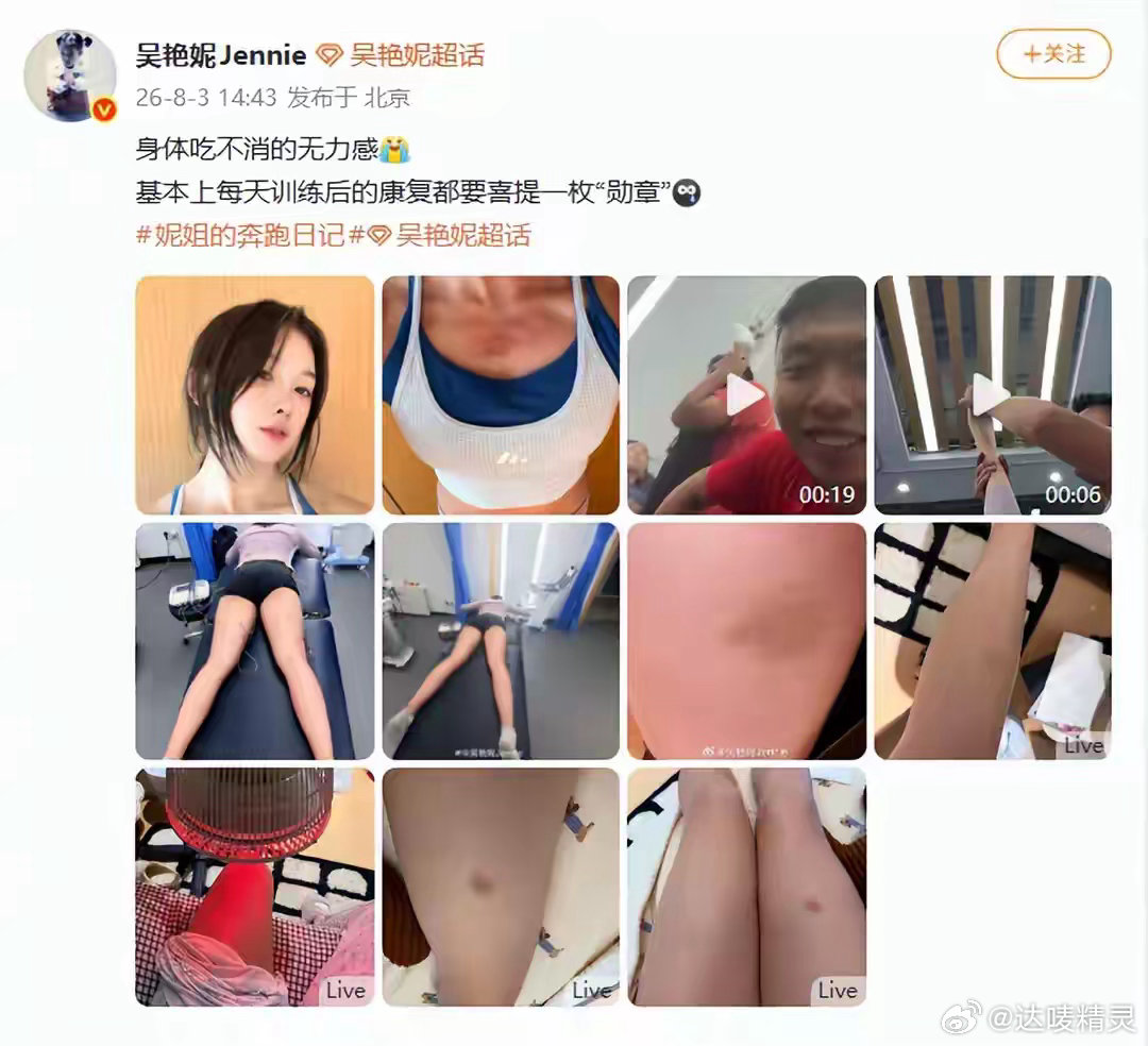 吴艳妮晒出身上多处淤青照吴艳妮的训练日常：淤青和康复“勋章”。直呼身体吃不消，却