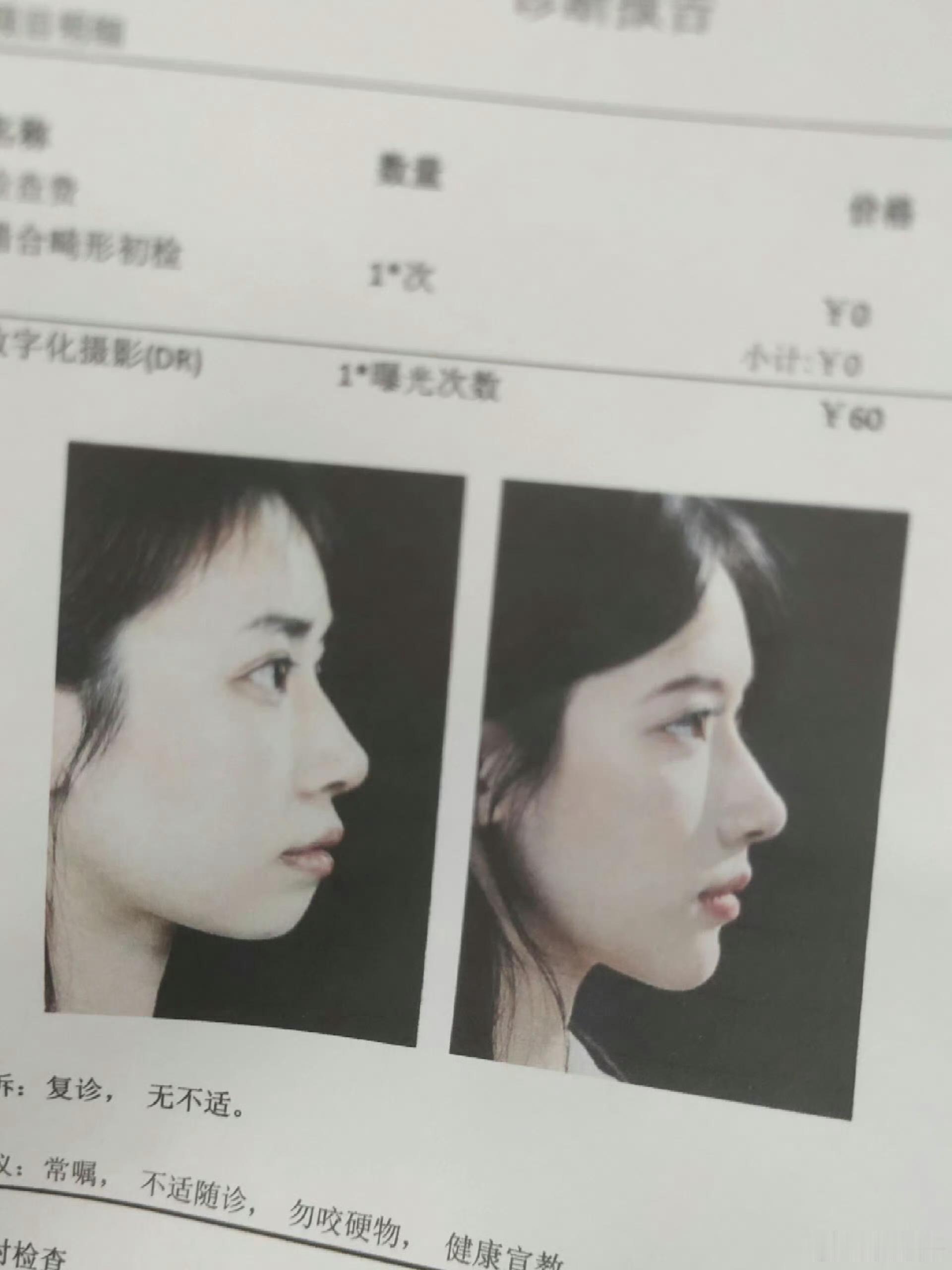 防止你不知道：牙齿对脸的影响有多大[哆啦A梦吃惊] ​​​