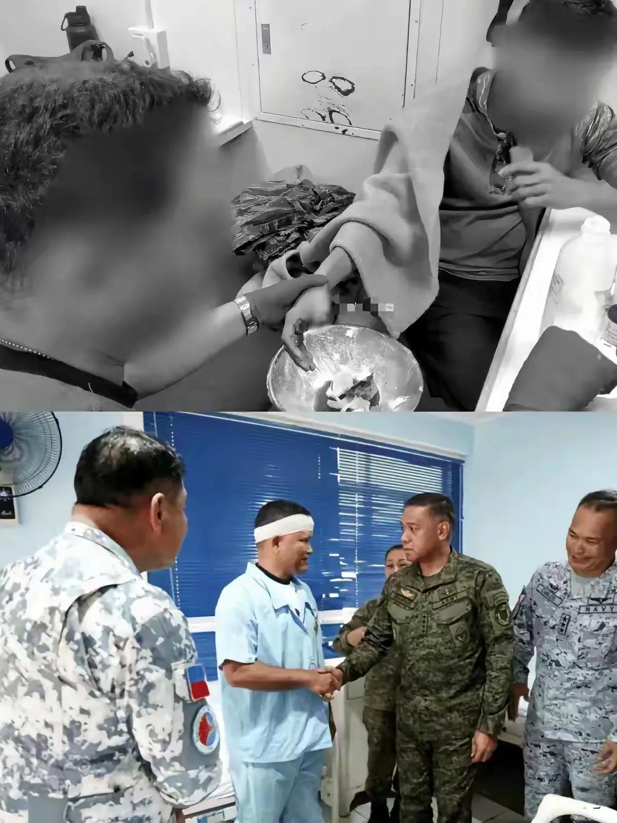 一根大拇指喂鱼来，失去手指的菲律宾士兵。

在昨天中国海警挫败菲律宾破船补给行动