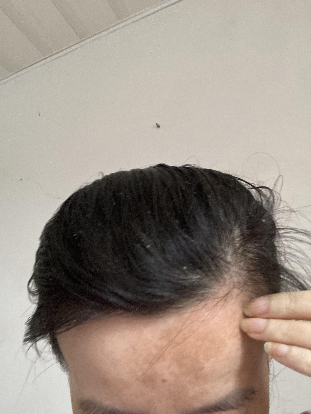 小的时候身体弱，经常生病发烧，不认识字的母亲带我们看诊所医生，哪有什么儿童医院。