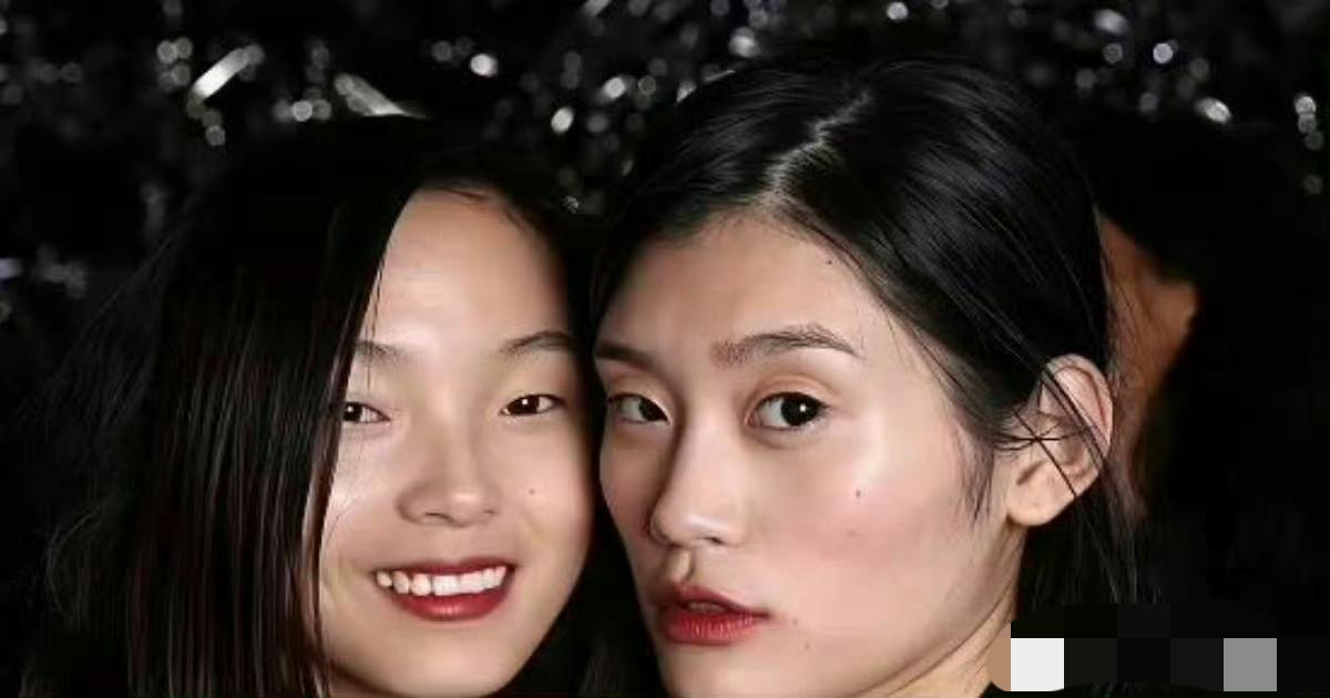 难怪奚梦瑶说她的脸花了很多的钱，这变化也太大了吧！这动得还不少啊！以前那张脸怕是