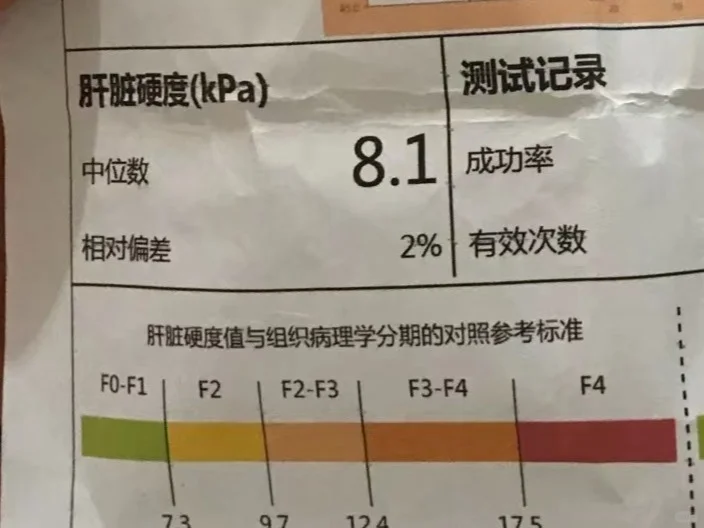 昨天接诊了29位肝病患者，其中有14位肝硬化患者，其中有6位明明能够逆...