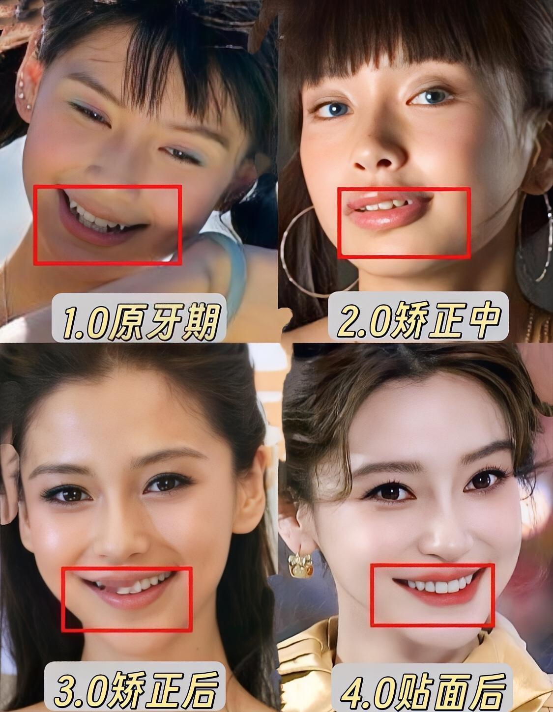 不愧是整牙天花板 每日打卡上热门