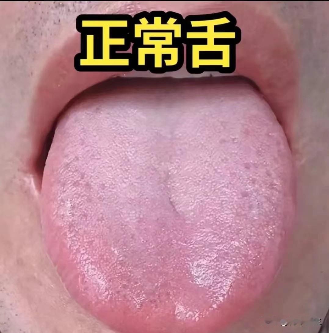 舌头什么样，身体什么病，看舌辨病要是学会了，医院去的少
今天我把常见的门诊最常见