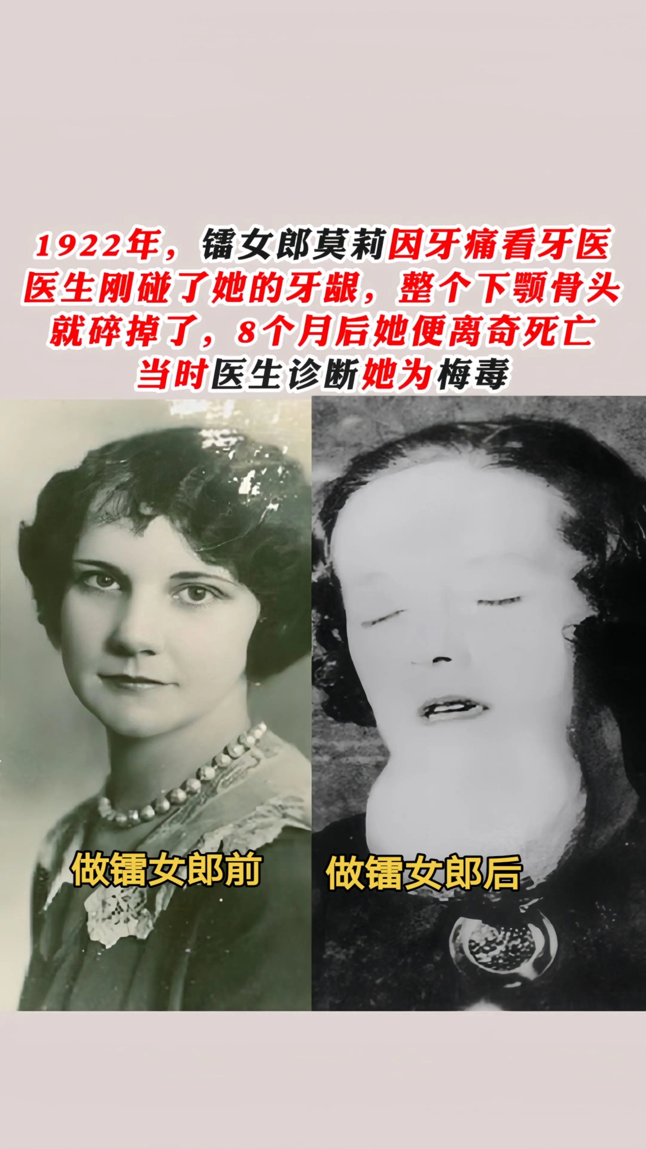 1920年代镭女郎的遭遇有多惨?！