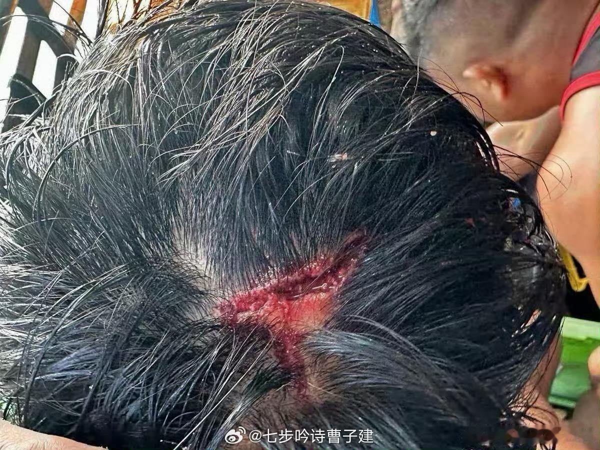 菲方围顶冲撞中方巡逻艇棍子敲好评，下次打个猴脑 上海