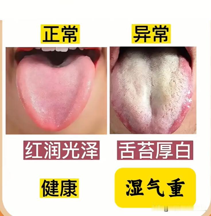 看舌知健康，对照看看你是哪种？