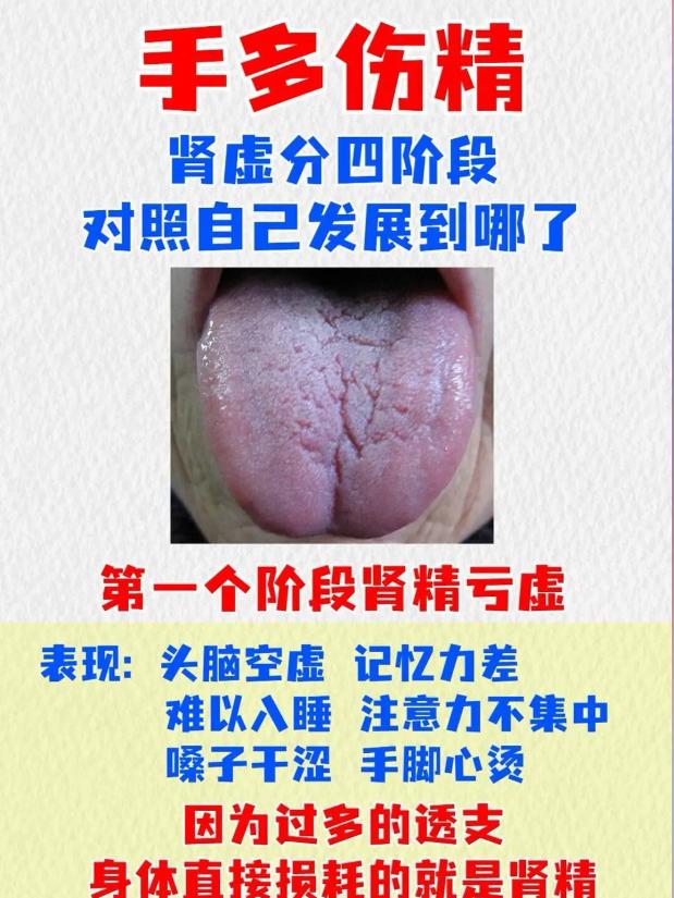 肾精耗损分 4 阶段，对照看看你到哪一步了？