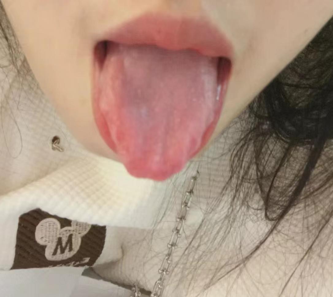 真的太无知了！吃了一个月的药，舌苔都变黄了，身体没调好，毛病却更多了[黑线][黑