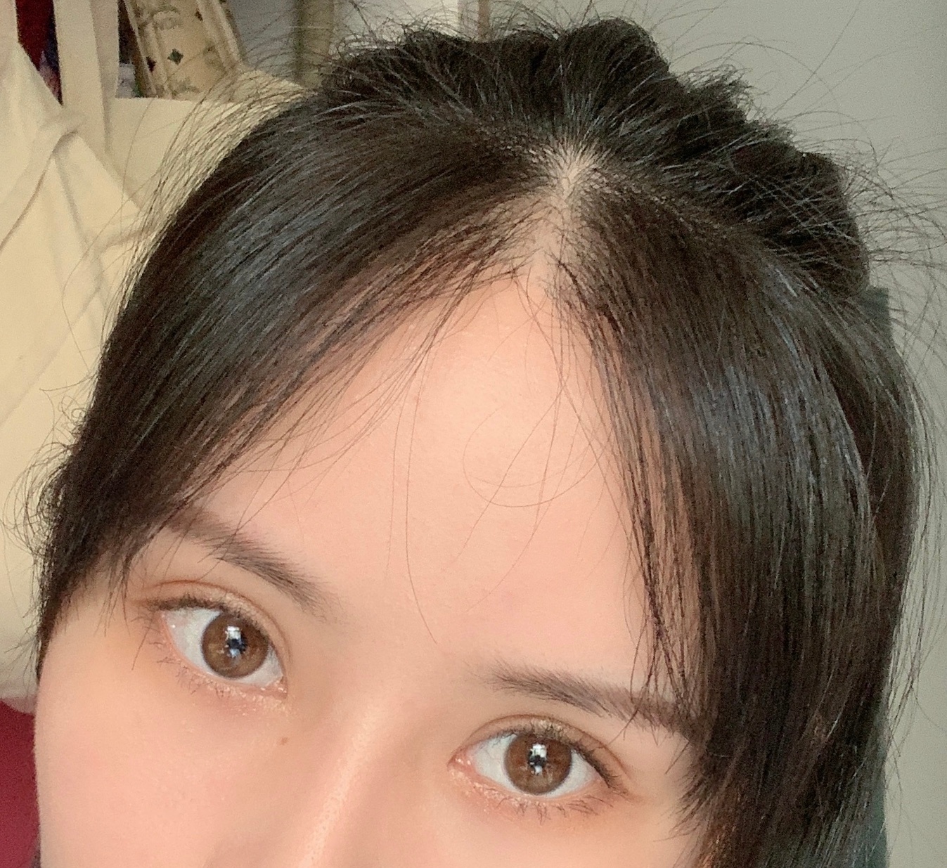 我做双眼皮的经历算是经历过双眼皮技术的变迁，还有中韩之间的结合吧，2026年了有