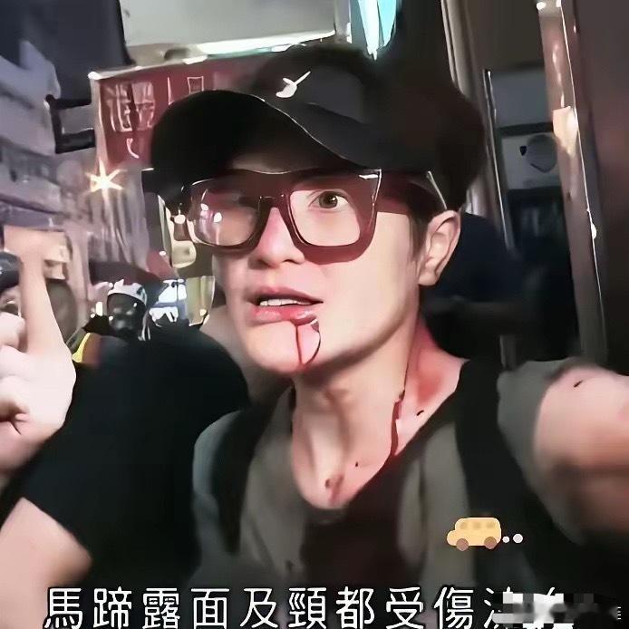 张敬轩支持港独，分裂国家是重罪，港独的最终归宿是监狱，如果他还能重返舞台大捞特捞